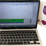 Herzkohärenz-Messung mit dem emWave Pro Plus